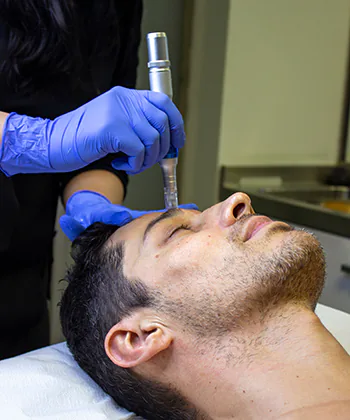 A photo representing Dermapen4 Microneedling treatment