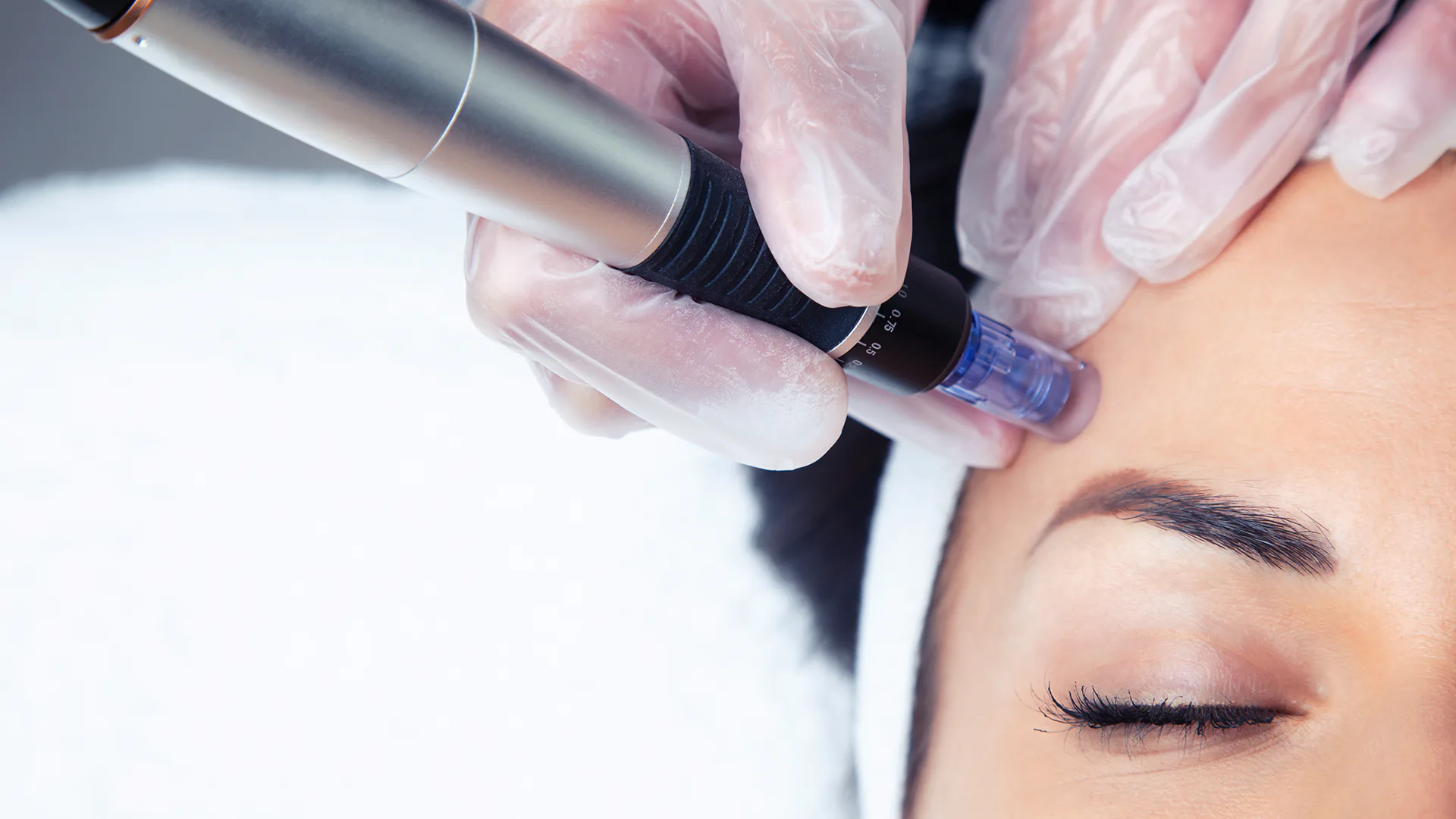 Resizable background image representing Dermapen 4 Microneedling Treatment 